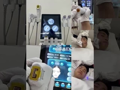 12d hifu +vmax +M8 +ICE HAMMER 4 IN 1 試聴する